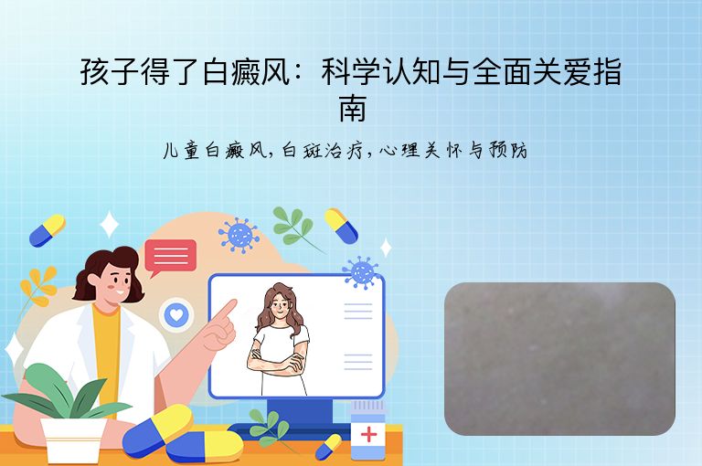 孩子得了白癜风：科学认知与全面关爱指南”