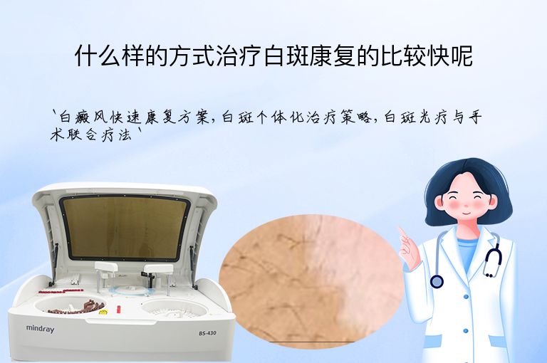 什么样的方式治疗白斑康复的比较快呢