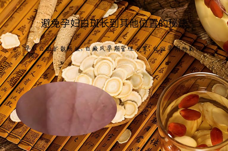 避免孕妇白斑长到其他位置的秘诀