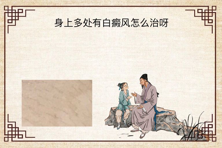 身上多处有白癜风怎么治呀”