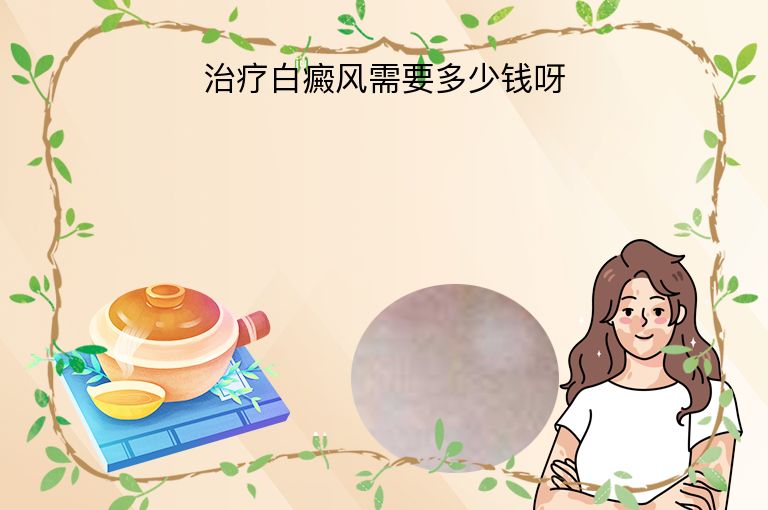 治疗白癜风需要多少钱呀”
