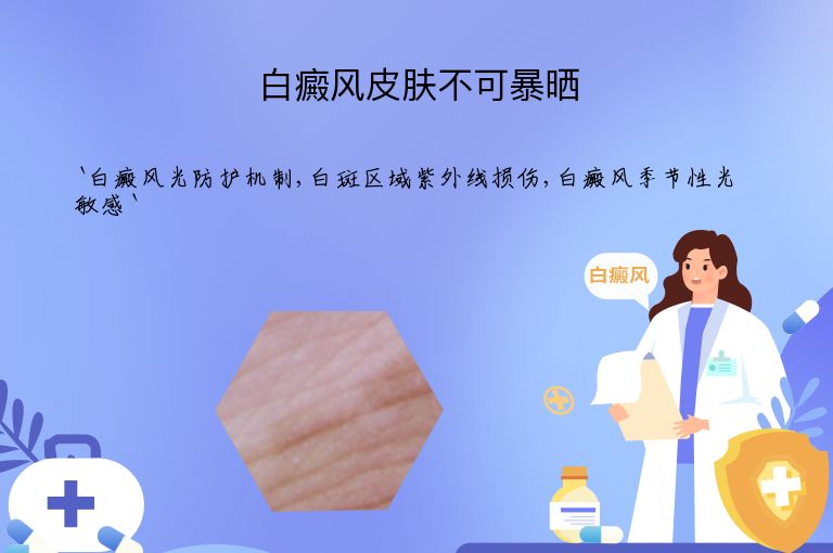 白癜风皮肤不可暴晒