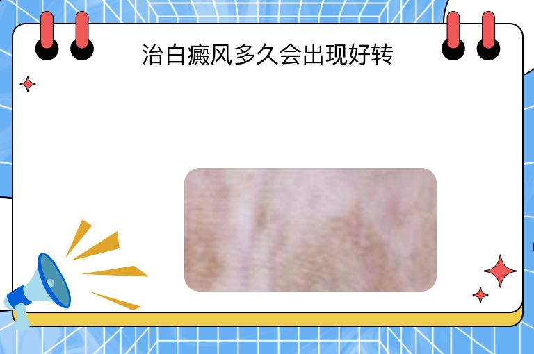 治白癜风多久会出现好转”