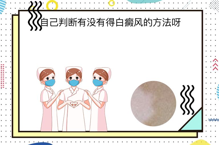 自己判断有没有得白癜风的方法呀”