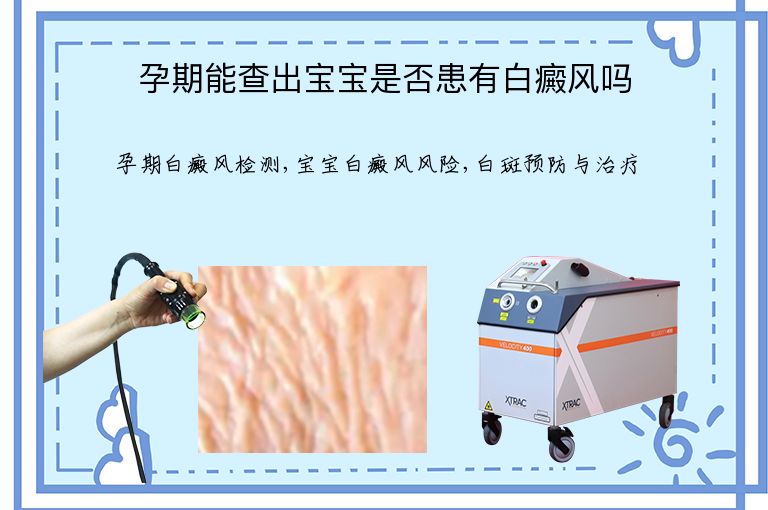 https://www.bdfsjzyy.com/d/file/p/a222bfefc69e0cb8f0c5d996ca8a742d.jpeg
