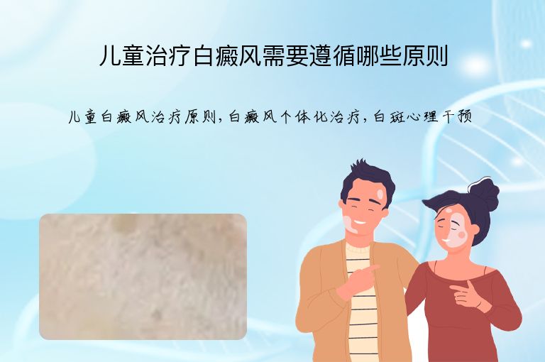 儿童治疗白癜风需要遵循哪些原则”
