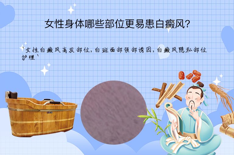 女性身体哪些部位更易患白癜风?”