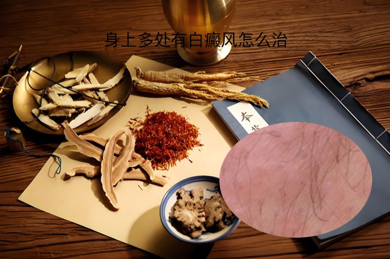https://www.bdfsjzyy.com/d/file/p/90c47b3adf981be9a3d5c44349c55e33.jpeg
