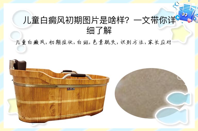 儿童白癜风初期图片是啥样？一文带你详细了解”
