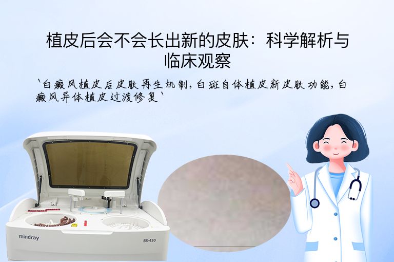 https://www.bdfsjzyy.com/d/file/p/ad4b83708b0e3e1ce5725dc4a639cfaf.jpeg
