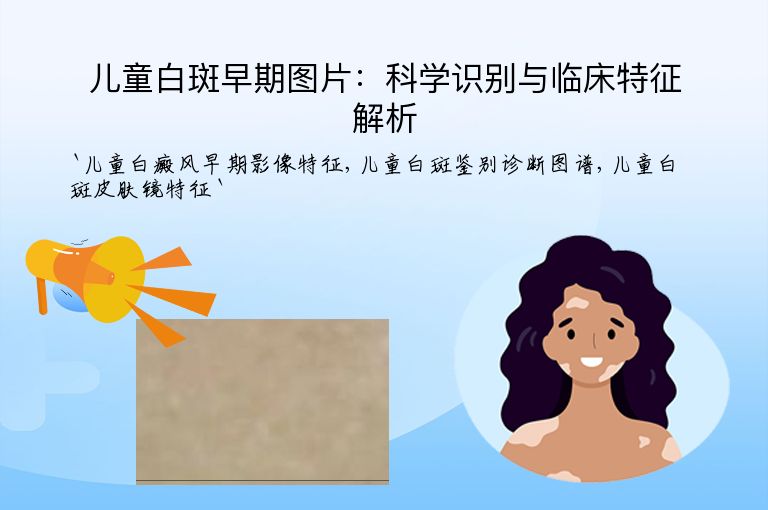 儿童白斑早期图片：科学识别与临床特征解析