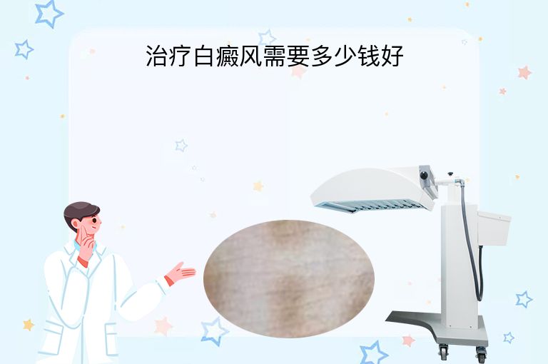 治疗白癜风需要多少钱好”