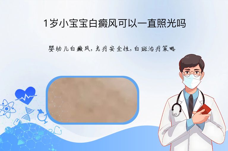 1岁小宝宝白癜风可以一直照光吗”