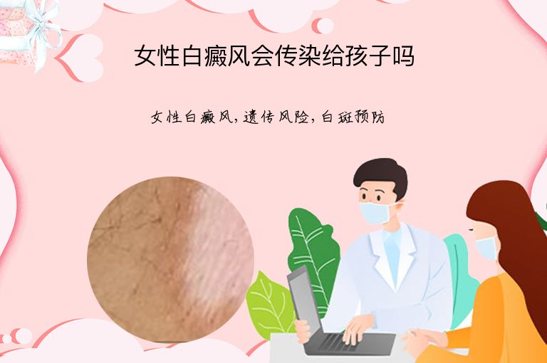 女性白癜风会传染给孩子吗”