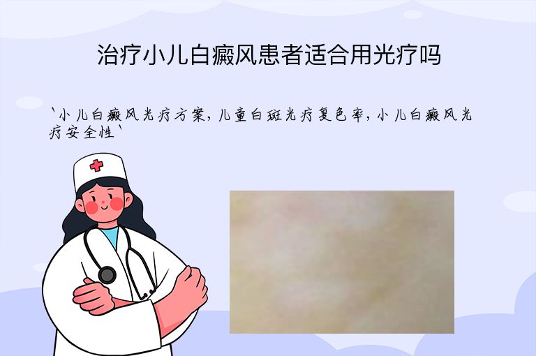 治疗小儿白癜风患者适合用光疗吗