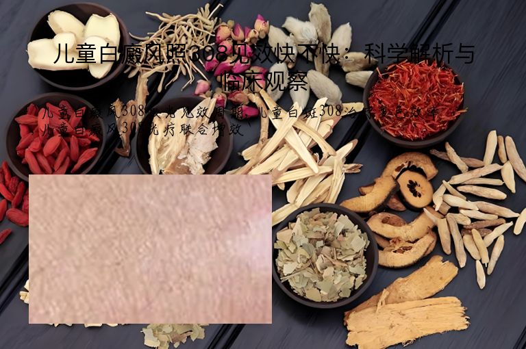儿童白癜风照308见效快不快：科学解析与临床观察