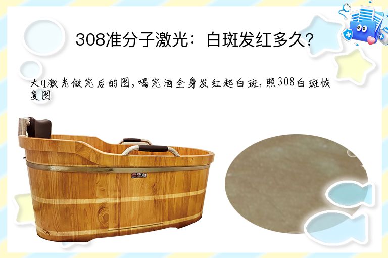 308准分子激光：白斑发红多久？”