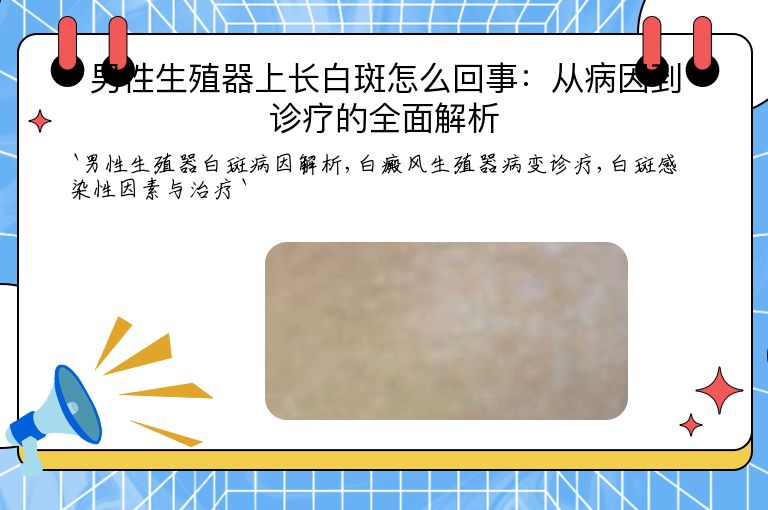 男性生殖器上长白斑怎么回事:从病因到诊疗的全面解析