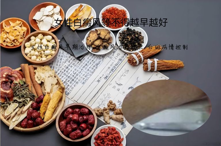 女性白癜风等不得越早越好”