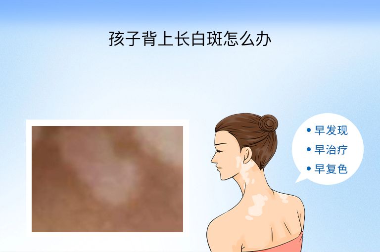 https://www.bdfsjzyy.com/d/file/p/08ee68d3d2430ec2612793cef5e8deb0.jpeg