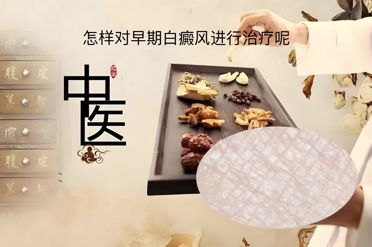怎样对早期白癜风进行治疗呢”