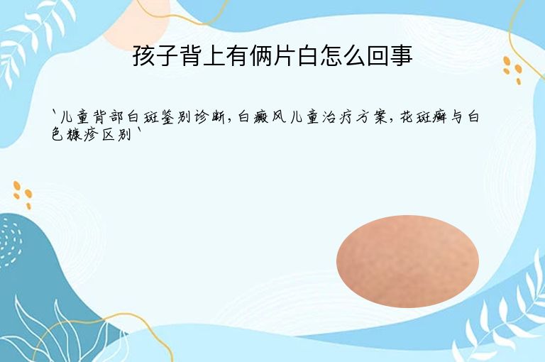 孩子背上有俩片白怎么回事
