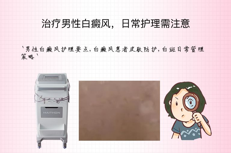 治疗男性白癜风,日常护理需注意