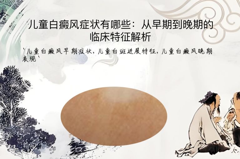 儿童白癜风症状有哪些:从早期到晚期的临床特征解析