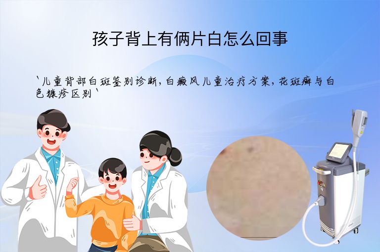 孩子背上有俩片白怎么回事