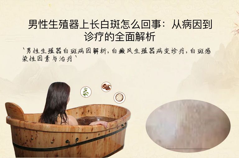 男性生殖器上长白斑怎么回事：从病因到诊疗的全面解析