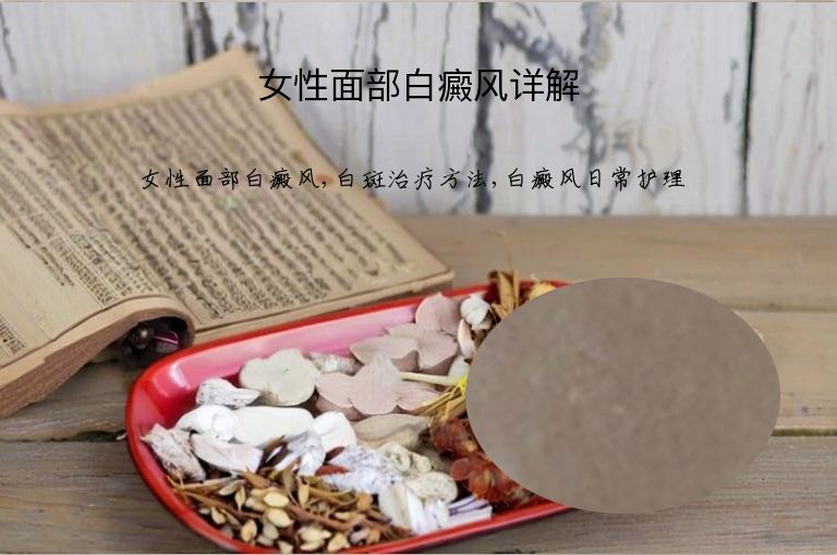 女性面部白癜风详解”