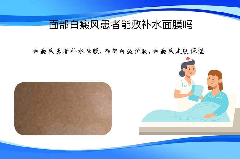 面部白癜风患者能敷补水面膜吗”