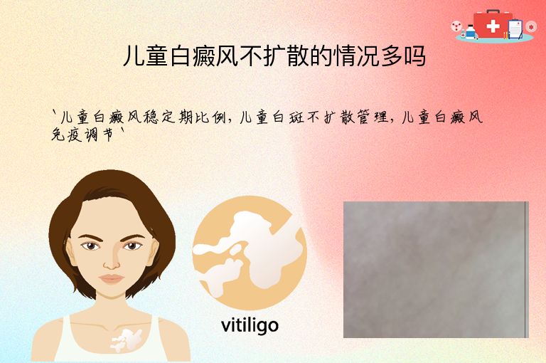 儿童白癜风不扩散的情况多吗”