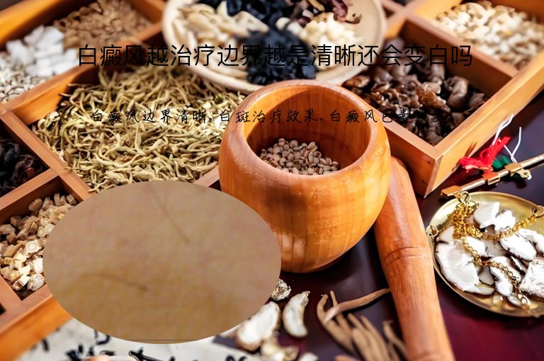 白癜风越治疗边界越是清晰还会变白吗”