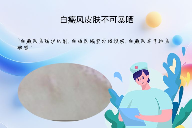 白癜风皮肤不可暴晒