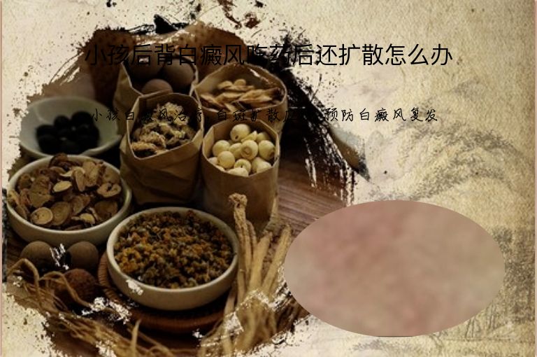 小孩后背白癜风吃药后还扩散怎么办”