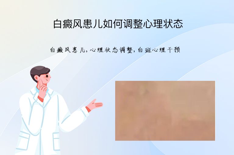 https://www.bdfsjzyy.com/d/file/p/a20eca25d8a00cd8dc73c271304ee19f.jpeg