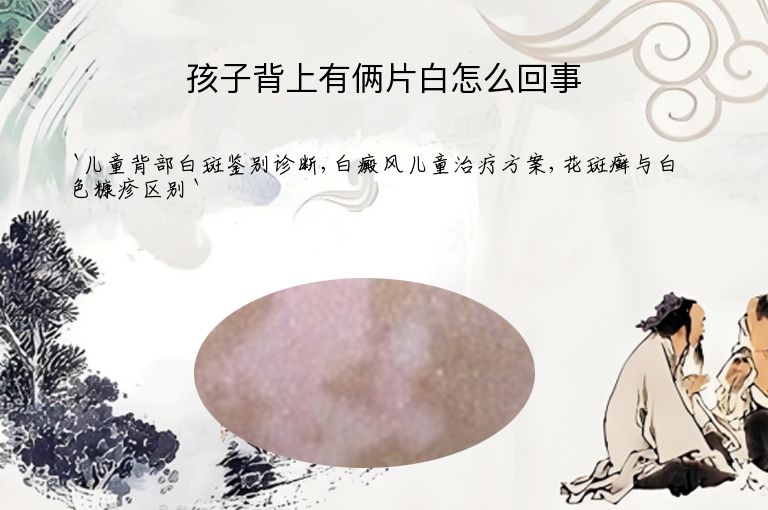 孩子背上有俩片白怎么回事
