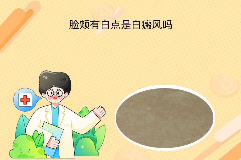 脸颊有白点是白癜风吗
