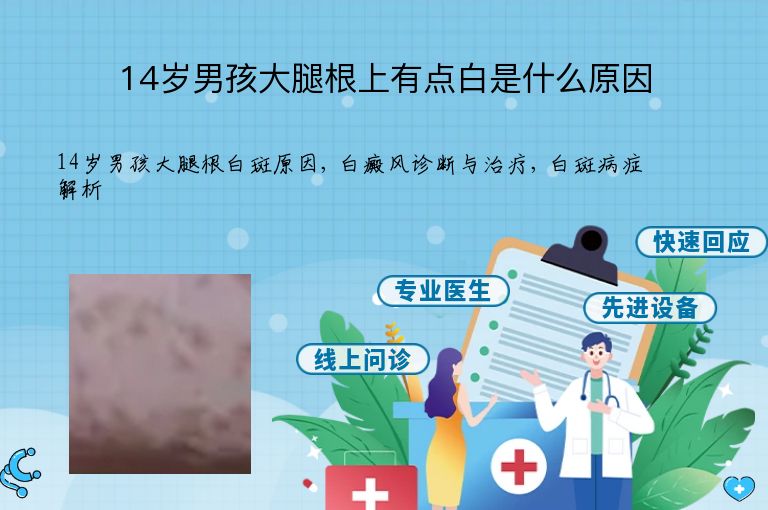 14岁男孩大腿根上有点白是什么原因”