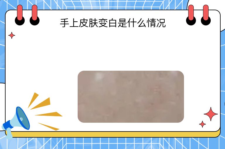 https://www.bdfsjzyy.com/d/file/p/39f69af4c149f70943984104b568a91d.jpeg