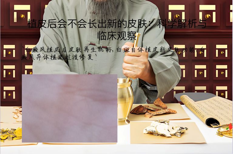 植皮后会不会长出新的皮肤：科学解析与临床观察”