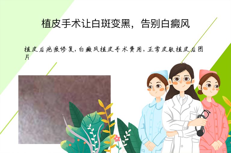 植皮手术让白斑变黑,告别白癜风”