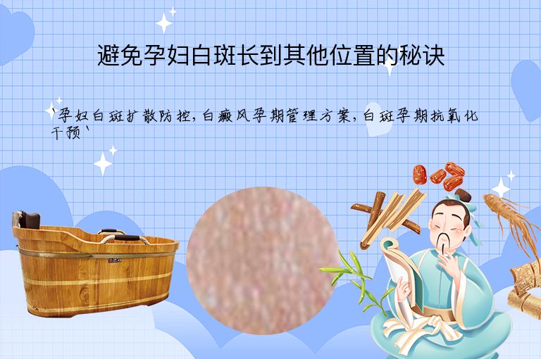 避免孕妇白斑长到其他位置的秘诀