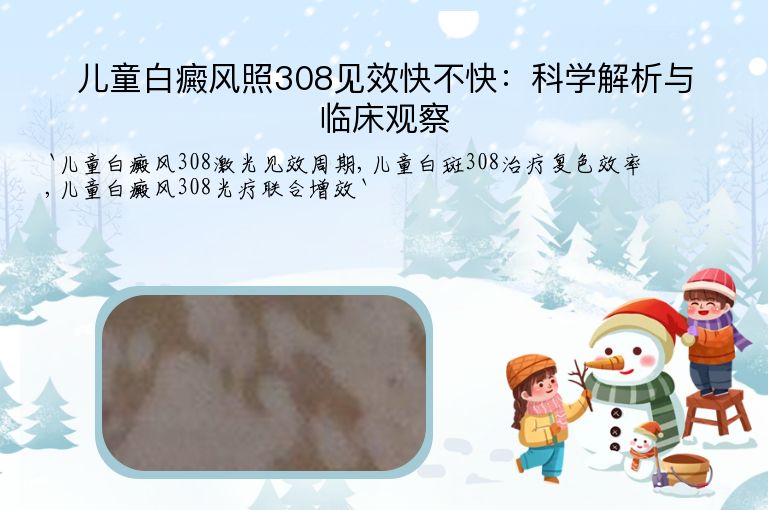 儿童白癜风照308见效快不快:科学解析与临床观察
