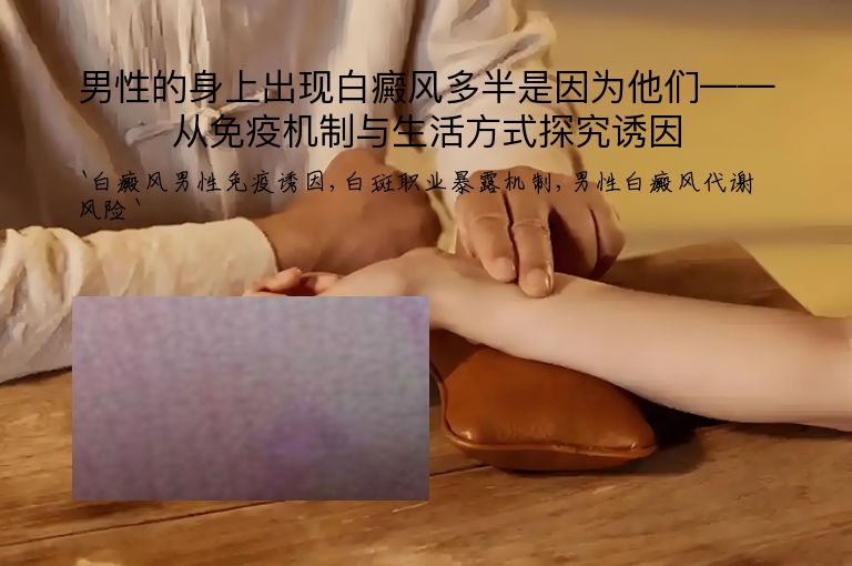 男性的身上出现白癜风多半是因为他们——从免疫机制与生活方式探究诱因