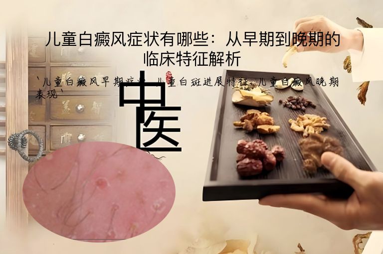 儿童白癜风症状有哪些:从早期到晚期的临床特征解析