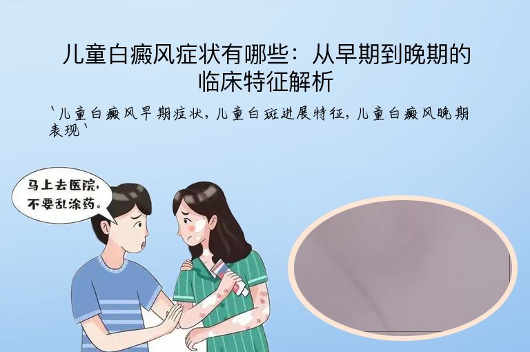儿童白癜风症状有哪些：从早期到晚期的临床特征解析