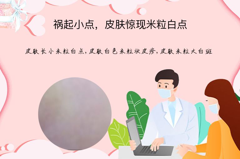 祸起小点，皮肤惊现米粒白点