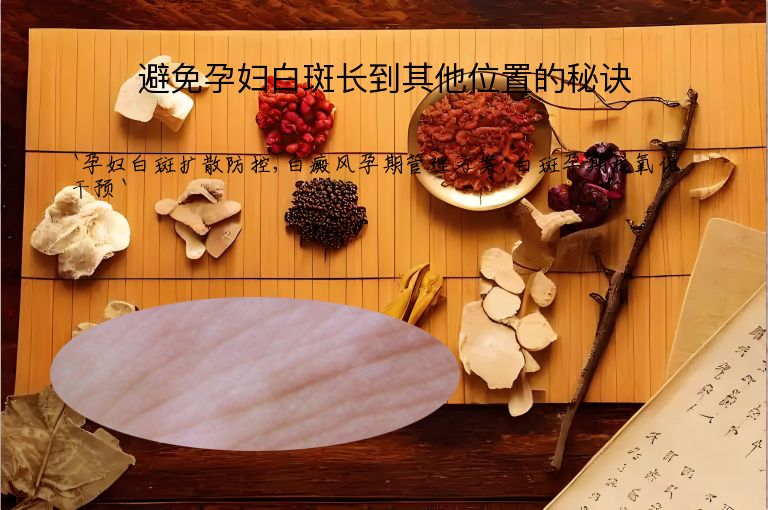 避免孕妇白斑长到其他位置的秘诀